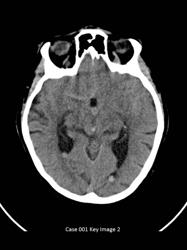 Key Image 2