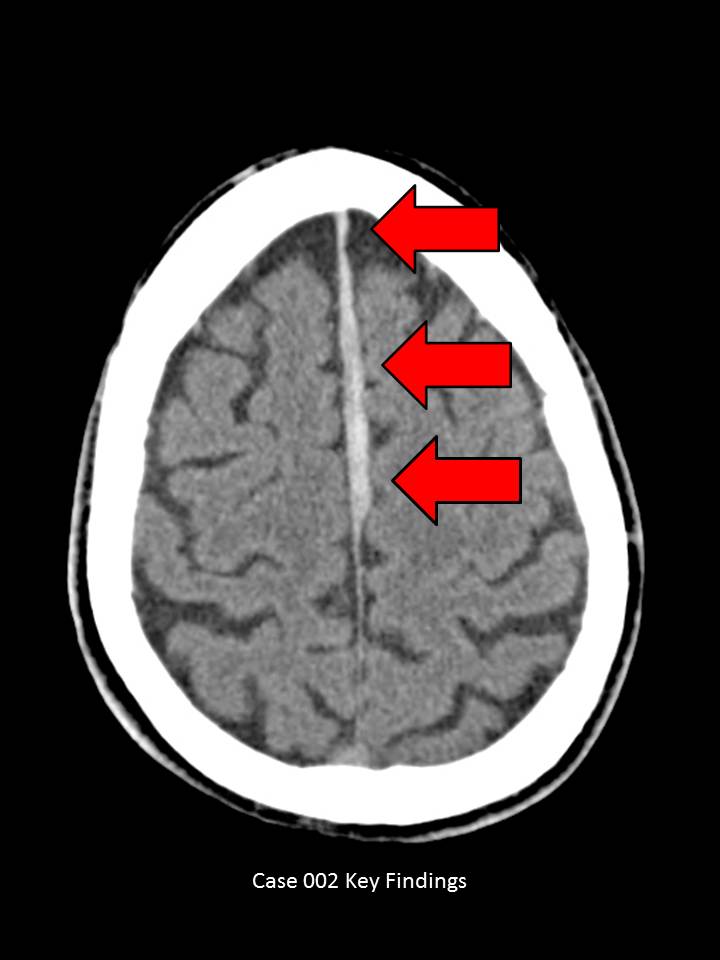 Key Finding 1
