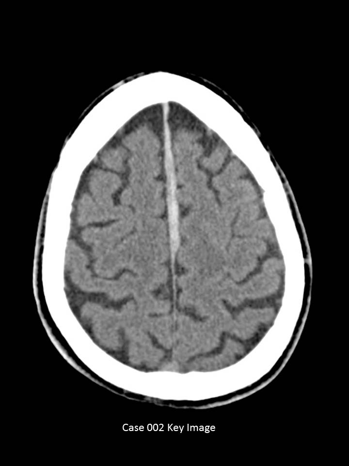 Key Image 1