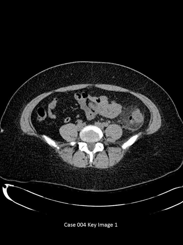 Key Image 1