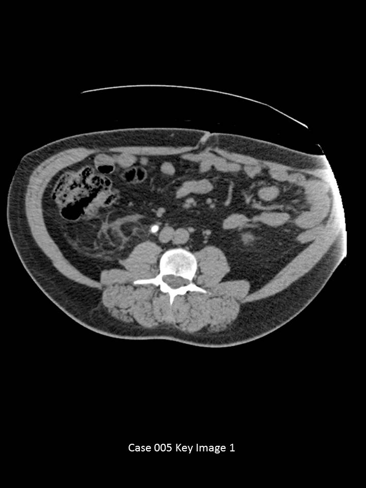 Key Image 1