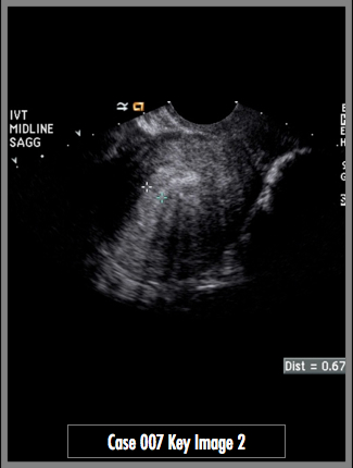 Key Image 2