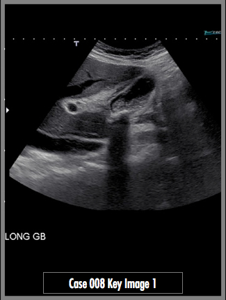 Key Image 1