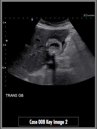 Key Image 2