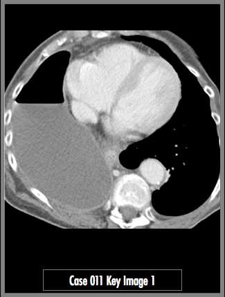 Key Image 1