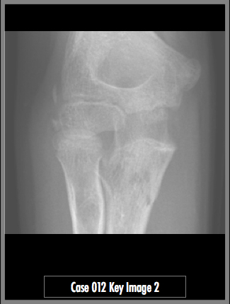 Key Image 2