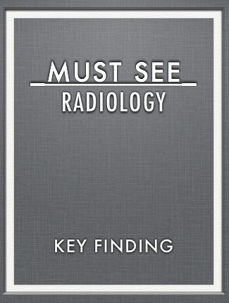 Key Finding 2