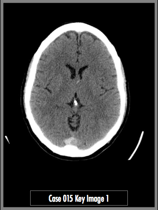 Key Image 1