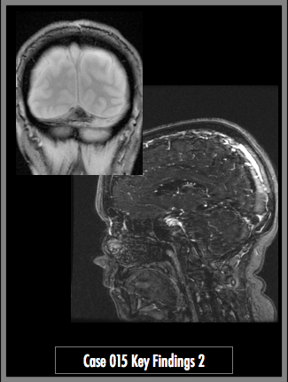 Key Image 2