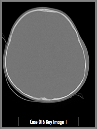Key Image 1