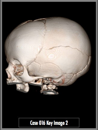 Key Image 2