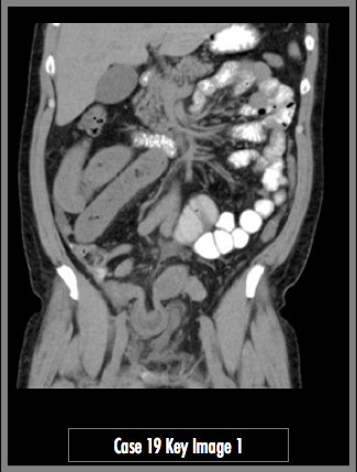 Key Image 1