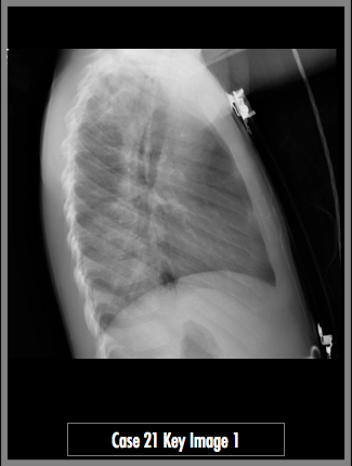 Key Image 1