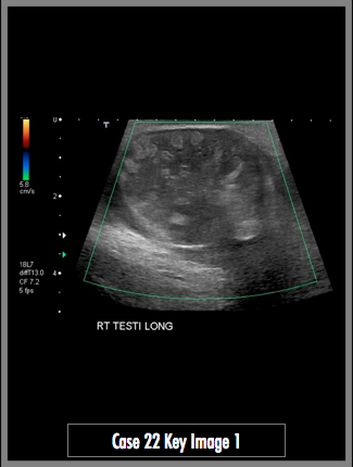 Key Image 1