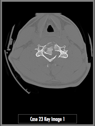 Key Image 1