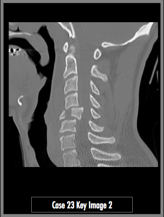 Key Image 2