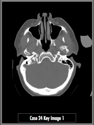 Key Image 1