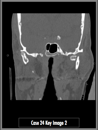 Key Image 2