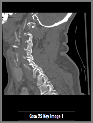 Key Image 1